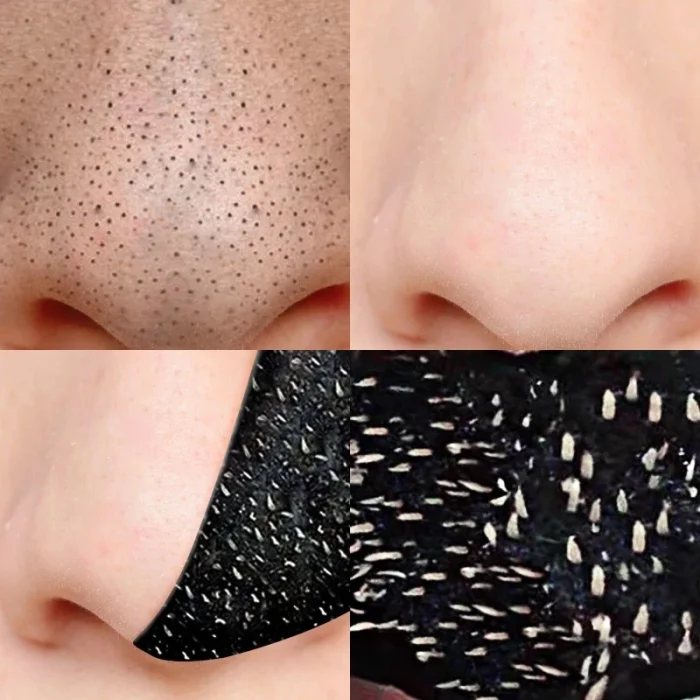 Unisex Deep Cleansing Nose Strips for Acne & Blackhead Removal Shrink Pore Nose Black Head Stickers Skin Care Patch - Image 16