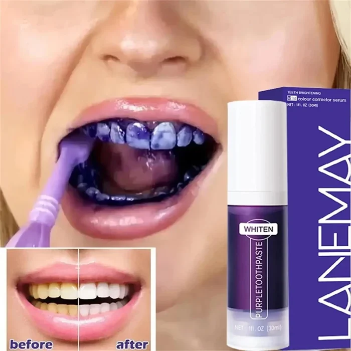 V34 Teeth Whitening Toothpaste 5D Teeth Whitening Stick Oral Hygiene Cleaning Teeth Whitening Tool Fresh Breath Teeth Care New - Image 8