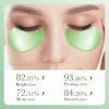 60pcs SAODER Aloe Vera Collagen Eye Mask Anti Dark Circles Eyes Bags Moisturizing Firming Eye Patches Eyes Skin Care Products - Image 4