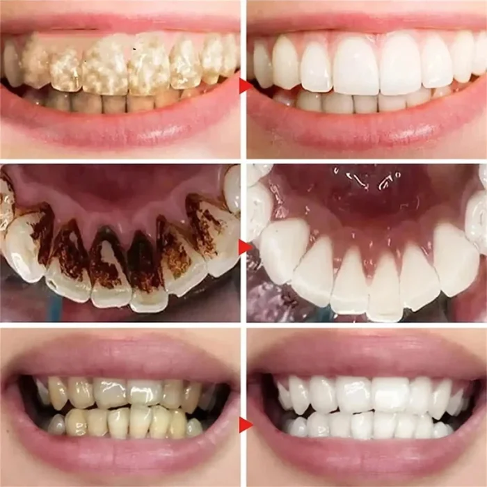 V34 Teeth Whitening Toothpaste 5D Teeth Whitening Stick Oral Hygiene Cleaning Teeth Whitening Tool Fresh Breath Teeth Care New - Image 17