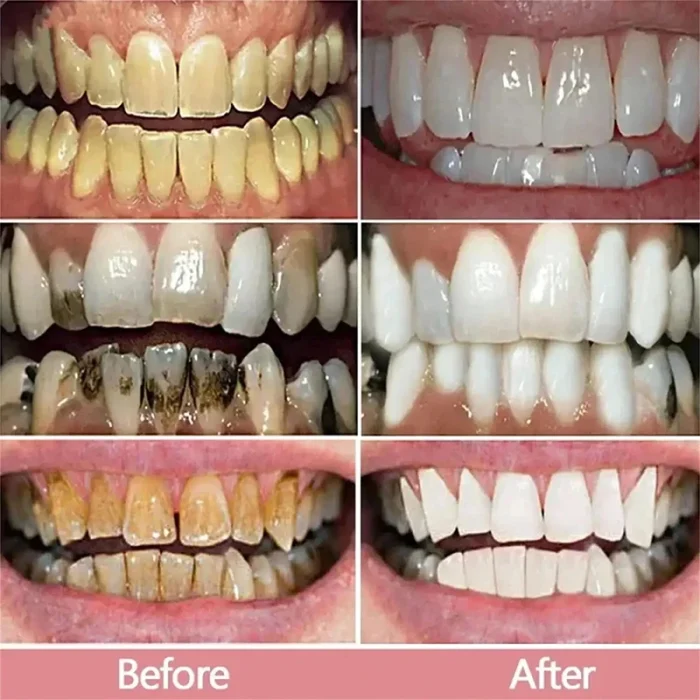 V34 Teeth Whitening Toothpaste 5D Teeth Whitening Stick Oral Hygiene Cleaning Teeth Whitening Tool Fresh Breath Teeth Care New - Image 14
