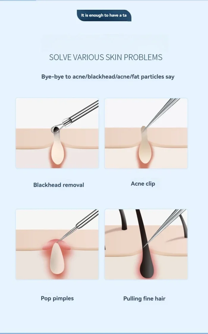 11Pcs Ingrown Hair Tweezers Acne Blackhead Removal Needles Black Dots Cleaner Pore Cleaner Deep Cleansing Face Skin Care Tools - Image 11
