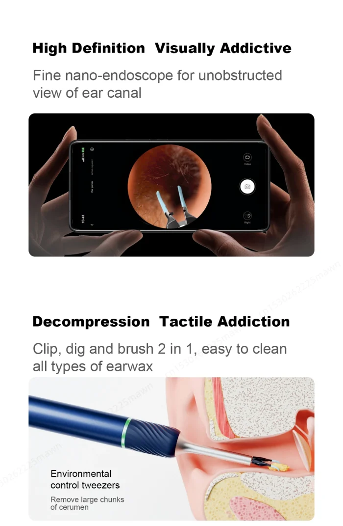 Bebird Note5 Pro Ear Cleaner Smart Visual Ear Wax Sticks Endoscope Tweezers Earpick Mini Camera Otoscope Personal Health Care - Image 17