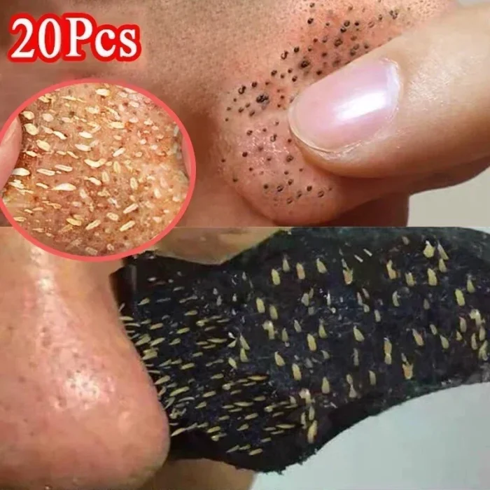 10-50PCS Nose Blackhead Remover Mask Shrink Pore Acne Treatment Sticker Black Dots Strips Nose Deep Cleansing Cleaner Skin Care - Image 4
