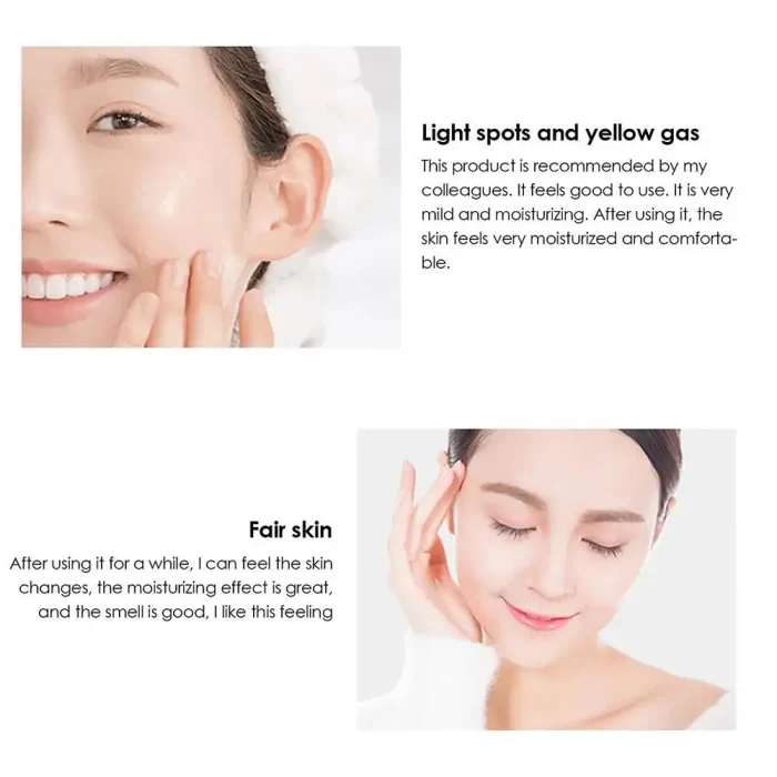 Whitening Cream Anti Freckle Face Cream, Remove The Black，Melasma Dark Spot Acne Deposits On The Skin,Brighten Skin Care؜ - Image 2