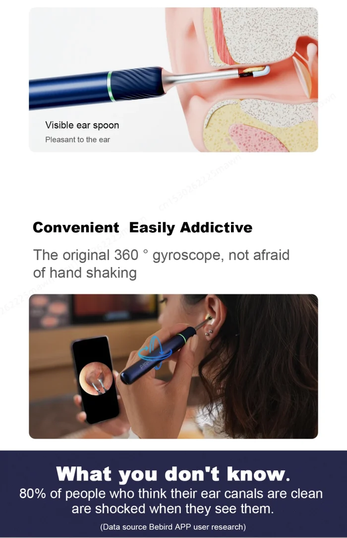 Bebird Note5 Pro Ear Cleaner Smart Visual Ear Wax Sticks Endoscope Tweezers Earpick Mini Camera Otoscope Personal Health Care - Image 18