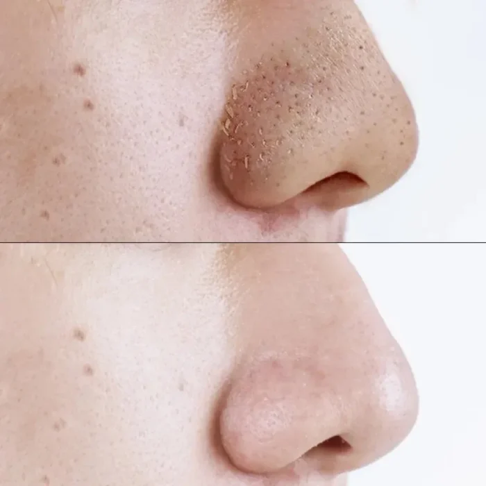 10-50PCS Nose Blackhead Remover Mask Shrink Pore Acne Treatment Sticker Black Dots Strips Nose Deep Cleansing Cleaner Skin Care - Image 18