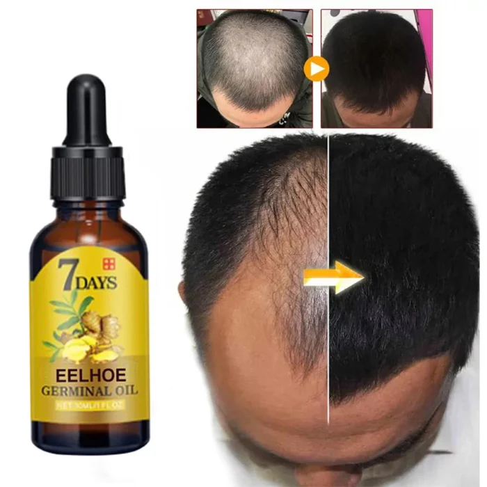 Ginger Hair Care Liquid Prevent Hair Loss Nourish Hair Follicles Strengthen Hair Roots Increase Hair Luster Nutrition Essence - Image 3