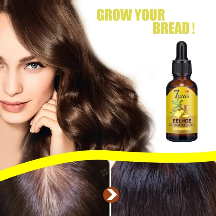 EELHOE Ginger Hair Growth Oil Natural Essentail Anti-Hair Loss Treatment Hair Hydrating Growth Nutrient Solution Care Products - Image 4