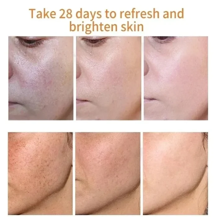 Fades Freckle Dark Spots Face Cream Niacinamide Whitening Cream Vitamin E Improve Dullness Fast Brighten Nourish Skin Care - Image 4