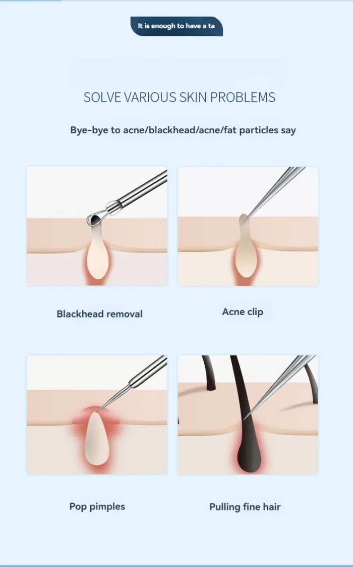 11Pcs Ingrown Hair Tweezers Acne Blackhead Removal Needles Black Dots Cleaner Pore Cleaner Deep Cleansing Face Skin Care Tools - Image 12