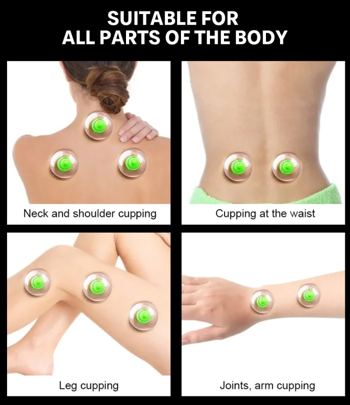 6Pcs Vacuum Cupping Sets with Pumping Gun Suction Cups Back Massage Body Cup Detox Anti Cellulite Cans Healthy Care Jars - Image 2