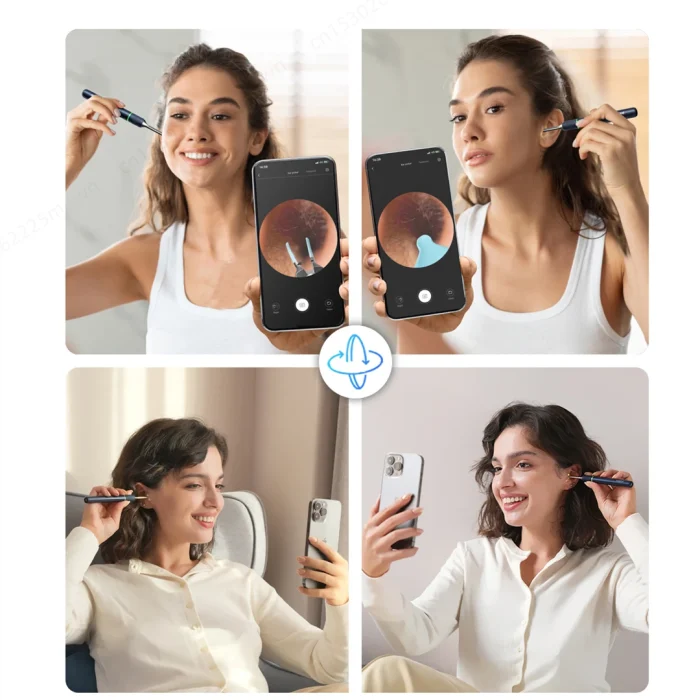 Bebird Note5 Pro Ear Cleaner Smart Visual Ear Wax Sticks Endoscope Tweezers Earpick Mini Camera Otoscope Personal Health Care - Image 5