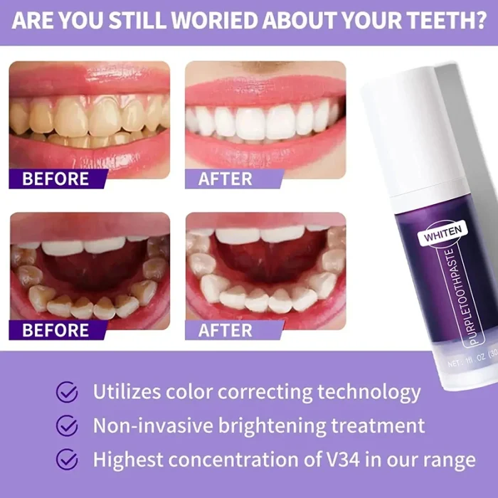V34 Teeth Whitening Toothpaste 5D Teeth Whitening Stick Oral Hygiene Cleaning Teeth Whitening Tool Fresh Breath Teeth Care New - Image 20