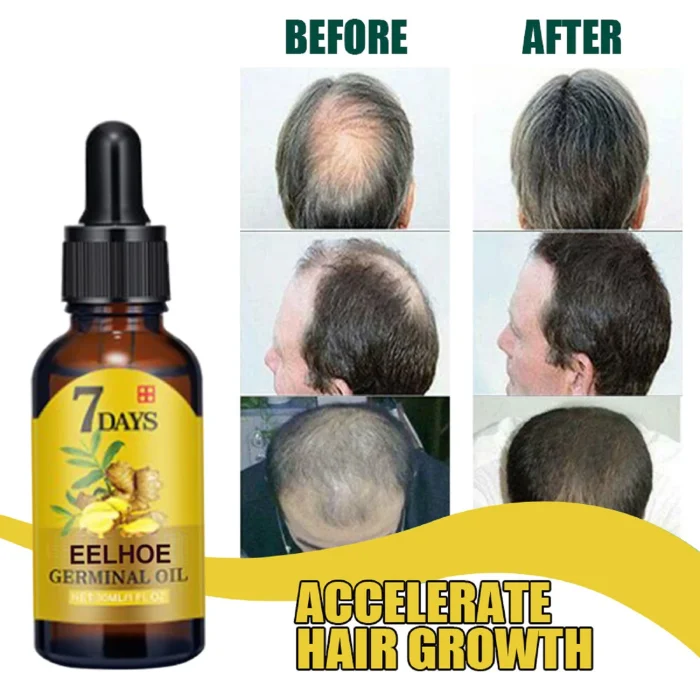 Ginger Hair Care Liquid Prevent Hair Loss Nourish Hair Follicles Strengthen Hair Roots Increase Hair Luster Nutrition Essence - Image 2