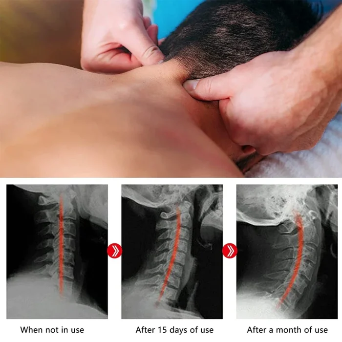 Neck and Shoulder Relaxer with Upper Back Massage Point, Cervical Traction Device Neck Stretcher for TMJ Pain Relief and Spine - Image 24