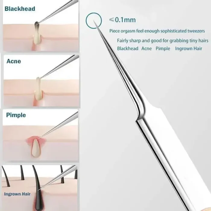 11Pcs Ingrown Hair Tweezers Acne Blackhead Removal Needles Black Dots Cleaner Pore Cleaner Deep Cleansing Face Skin Care Tools - Image 2