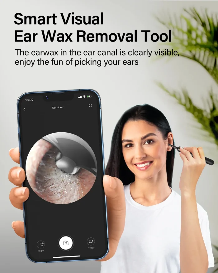 Bebird Xlife X0 Ear Cleaner Wax Remover Tool Smart Visual Stick Otoscope 1080P HD Earpick Endoscope Earring Personal Health Care - Image 9