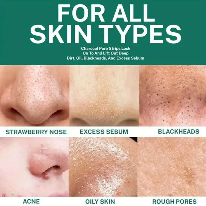 Unisex Deep Cleansing Nose Strips for Acne & Blackhead Removal Shrink Pore Nose Black Head Stickers Skin Care Patch - Image 5