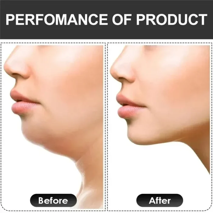 U Shape Jaw Exerciser New Facial Mouth Jawline Face Fitness Muscle Chew Ball Bite Breaker Training Equipment - Image 6