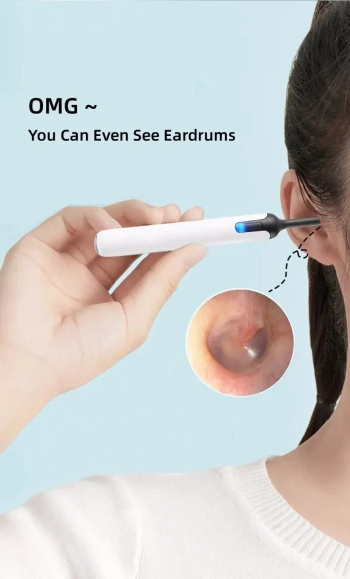 Bebird Xlife X0 Ear Cleaner Wax Remover Tool Smart Visual Stick Otoscope 1080P HD Earpick Endoscope Earring Personal Health Care - Image 14
