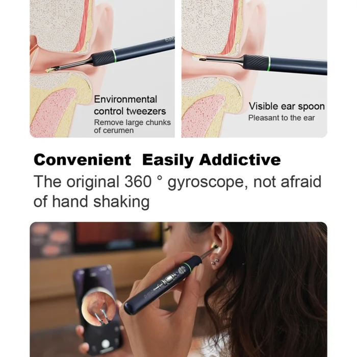 Bebird Note5 Pro Ear Cleaner Smart Visual Ear Wax Sticks Endoscope Tweezers Earpick Mini Camera Otoscope Personal Health Care - Image 2