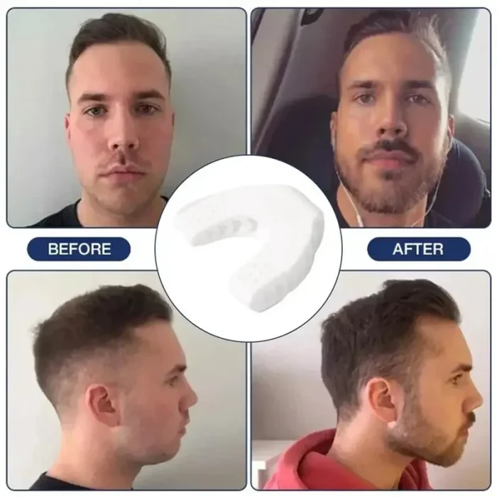 U Shape Jaw Exerciser New Facial Mouth Jawline Face Fitness Muscle Chew Ball Bite Breaker Training Equipment - Image 14