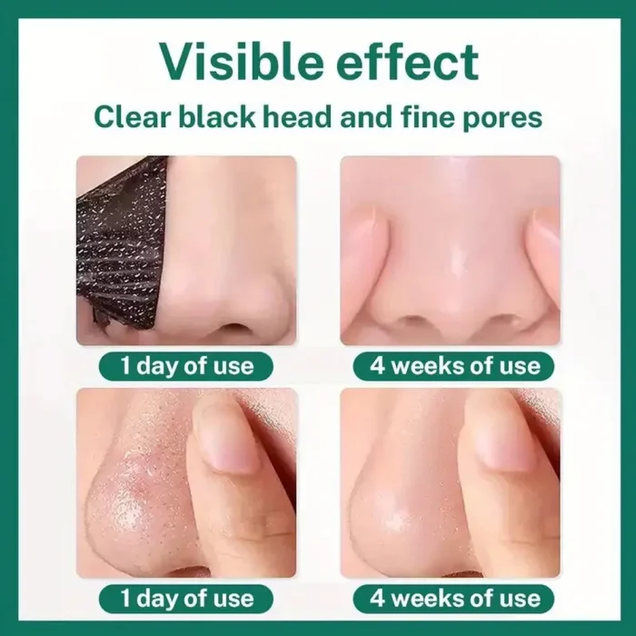 Unisex Deep Cleansing Nose Strips for Acne & Blackhead Removal Shrink Pore Nose Black Head Stickers Skin Care Patch - Image 4