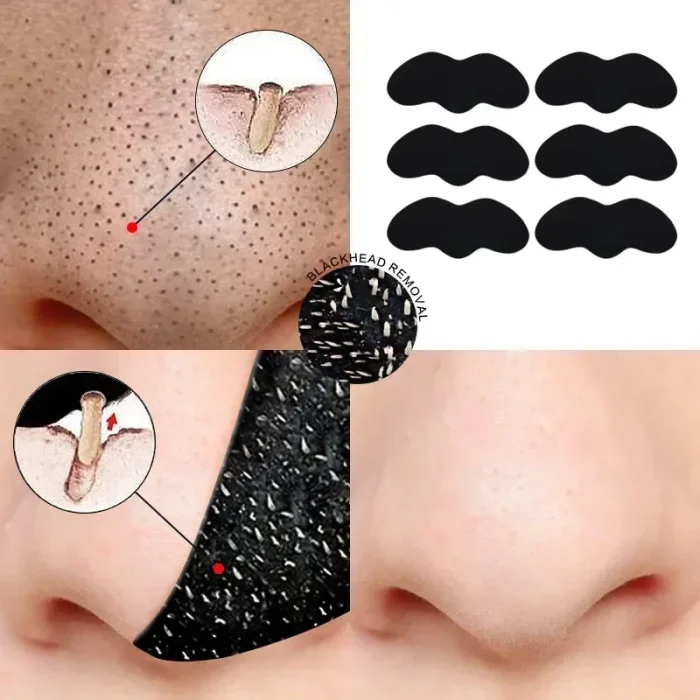 10-50PCS Nose Blackhead Remover Mask Shrink Pore Acne Treatment Sticker Black Dots Strips Nose Deep Cleansing Cleaner Skin Care - Image 2